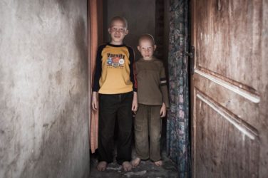 Albinos, Tanzania, Orodha, Tomás Correa